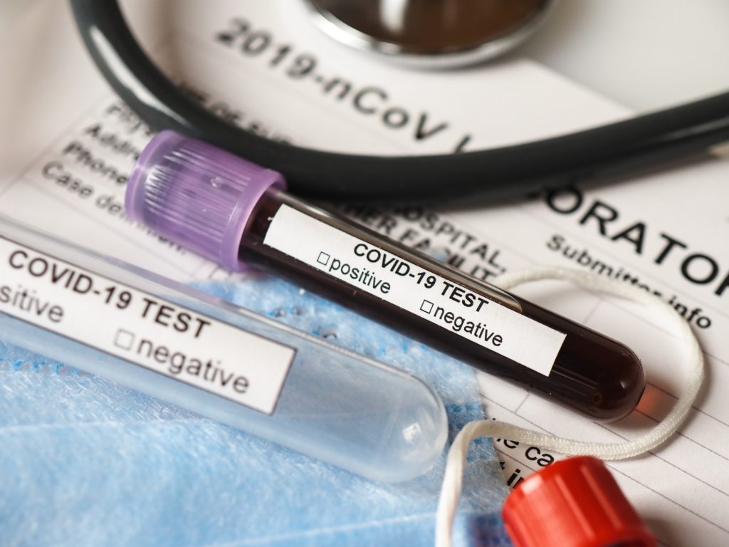 Concepto de prueba Coronavirus COVID-2019 con tubos de análisis de sangre, formulario de prueba y otros objetos médicos