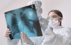 A 313 aumentaron los casos de tuberculosis en Villavicencio